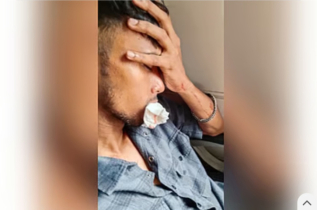 চলন্ত ট্রেনে পাথর নিক্ষেপ, ভাঙল কক্সবাজারফেরত যাত্রীর চার দাঁত