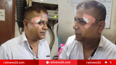 পাথরের আঘাতে লোকোমাস্টার আহত, অল্পের জন্য রক্ষা পেলেন চোখ