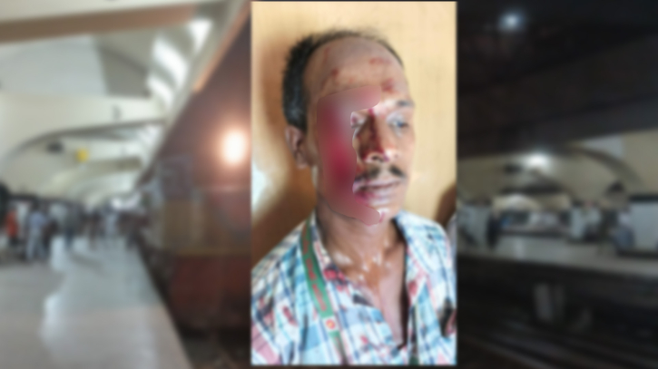দায়িত্ব পালন করতে গিয়ে হামলার শিকার রেলওয়ে কর্মী বাবুল মিয়া।