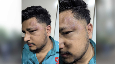 আখাউড়ায় মহানগর গোধূলীর স্টুয়ার্ডের ওপর যাত্রীর হামলা, চোখে গুরুতর আঘাত