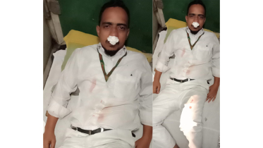শমসেরনগরে উদয়ন এক্সপ্রেসের এ্যাটেনডেন্টের ওপর যাত্রীর হামলা, নাকে গুরুতর আঘাত